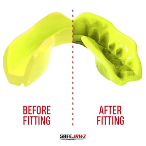 SAFEJAWZ Intro Series Mouthguard - Fluro Yellow - Muay Thailand