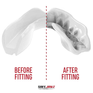 SAFEJAWZ Intro Series Mouthguard - White - Muay Thailand